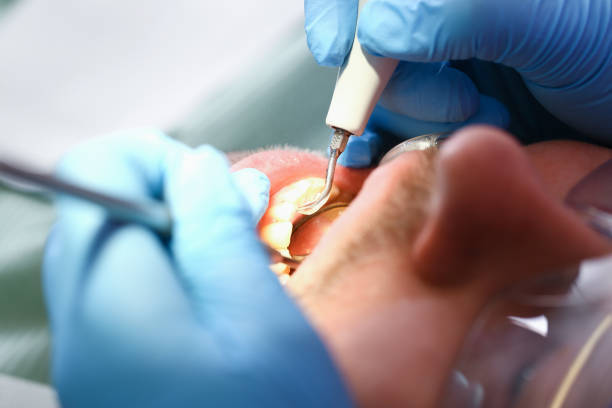 Best Root Canal Emergency Dentist  in Badin, NC